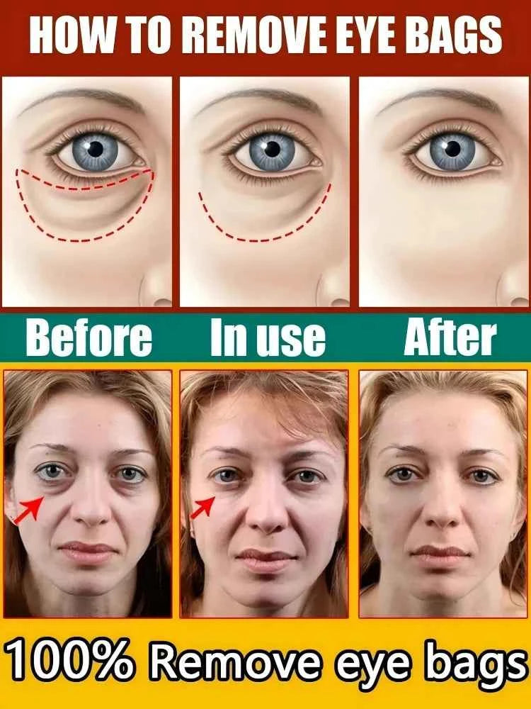 Anti-wrinkle Oxys Cream Wrinkle Face Cream Anti-Aging Face Lift Facial Massagers Facial Lift Wrinkles Remover Skin Product