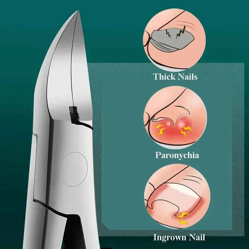 Professional Hawkbill Nail Clippers Nail Pick Trimmer for Ingrown Toenails Paronychia Cutter for Unisex Foot Care Manicure Tool